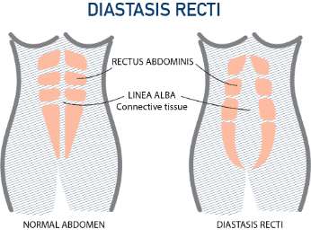 https://www.comparethemarket.com.au/health-insurance/exercising-pre-post-partum/