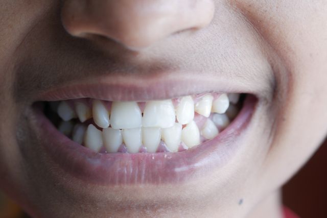 teen smiling big